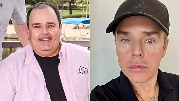 Muž odletěl do Mexika a po zákroku se vrátil jako nový člověk