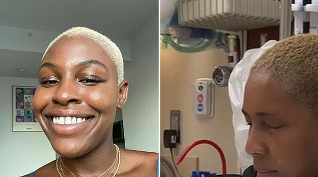 Místo očních kapek lepidlo. Žena kvůli chybě málem přišla o zrak