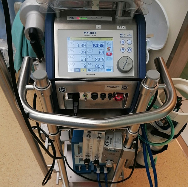 ECMO zachránilo chlapce, který byl půl hodiny pod ledem. Pomáhá i novorozencům