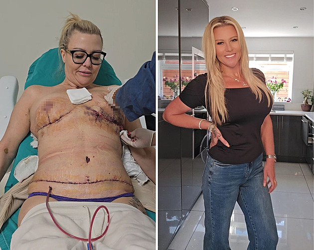 Žena podstoupila radikální proměnu, byla sešívaná na všech částech těla